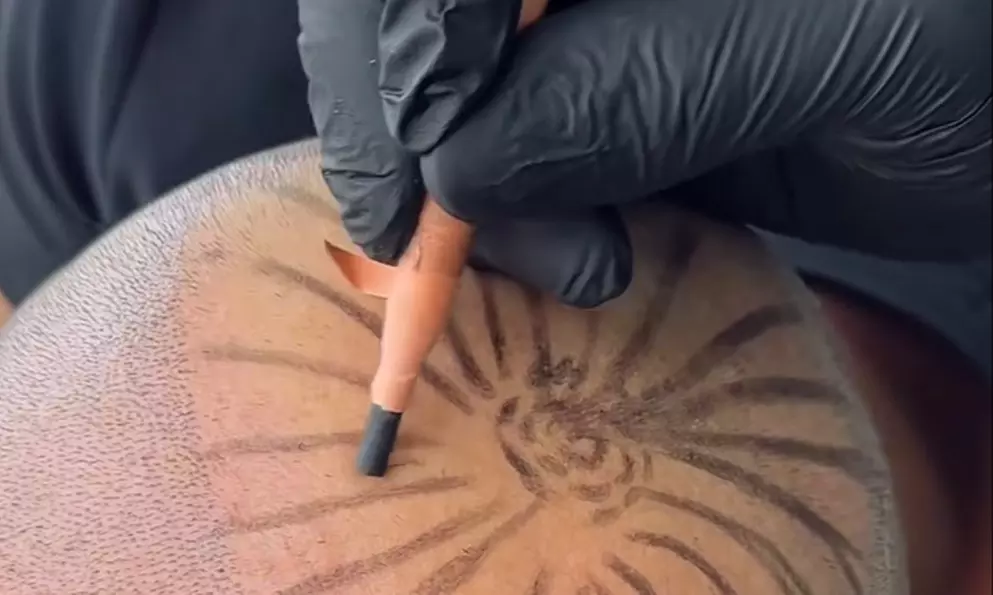 SMP Consultation w/ Hairline Focus, Density Boost for Hair Loss w/Care