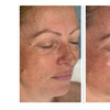 Image 6: Up to 55% Off on Facial - Chosen by Customer at Rise Skin Spa