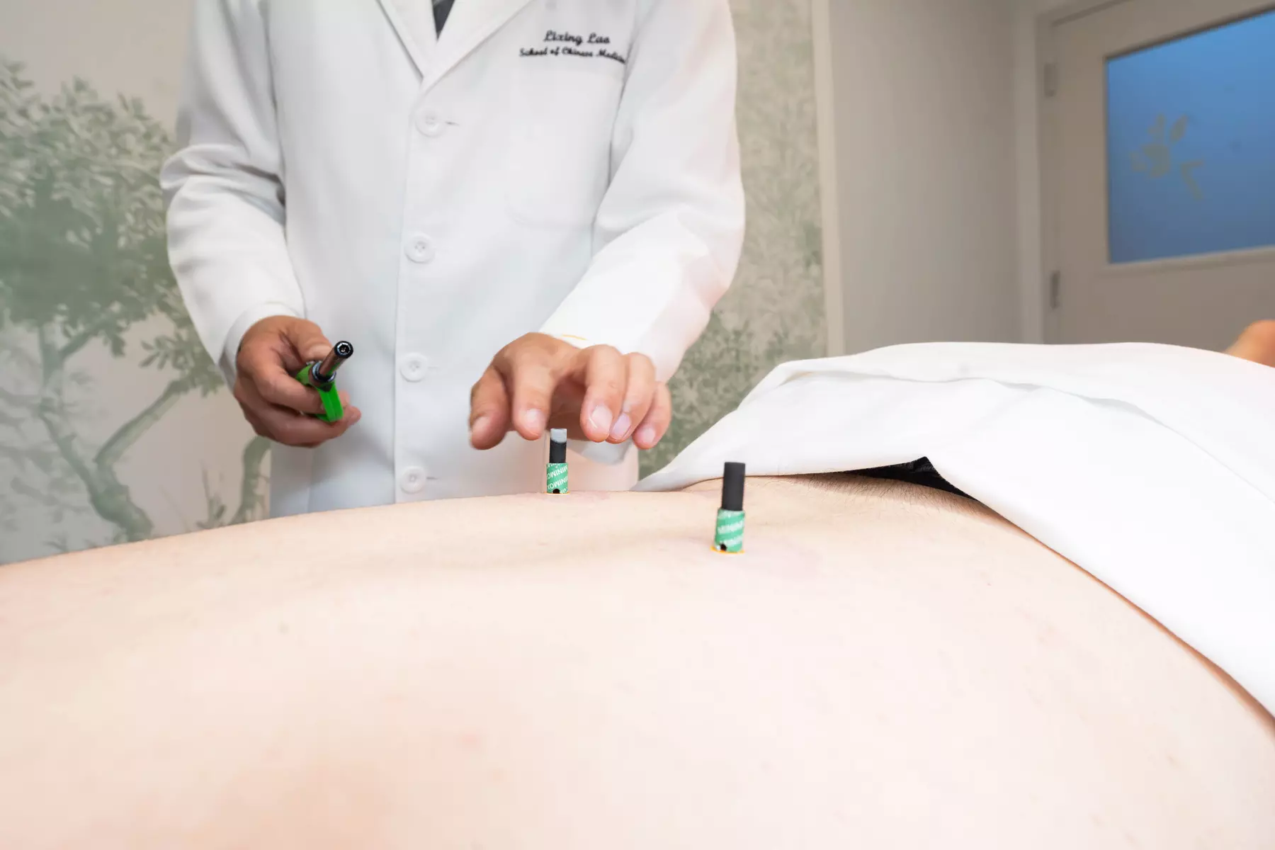 Up to 40% on Acupuncture at VUIM clinic and whole health