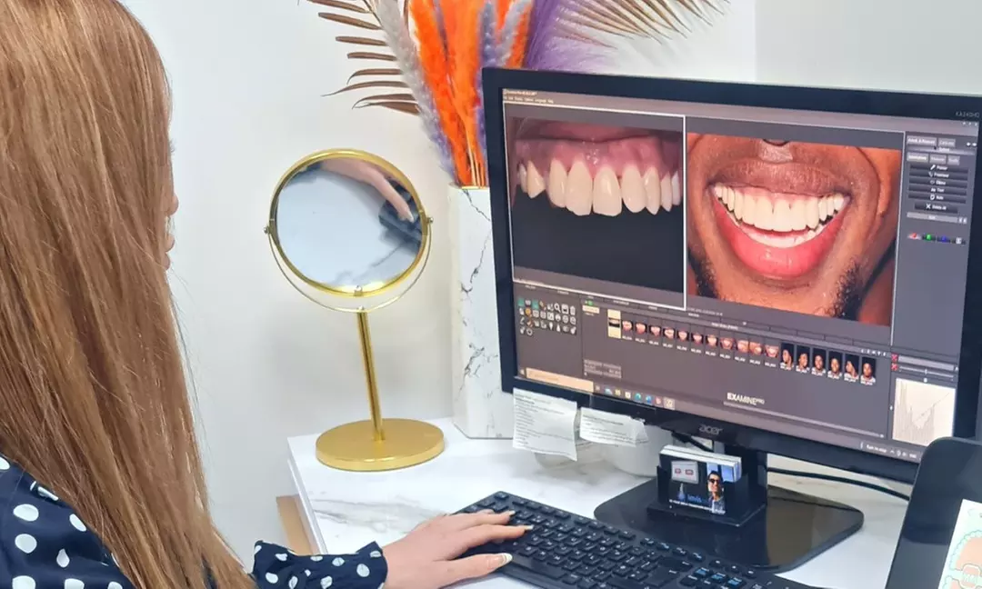 Clear or Metal Braces on One or Both Arches