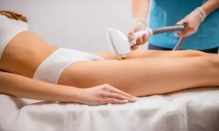 Up to 86% Off on Laser Hair Removal at Semper Laser - Second Medium