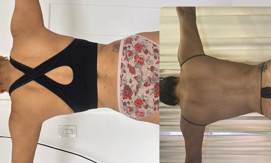 Image 1: Experience Non-Invasive Laser Lipo for a Sculpted Look