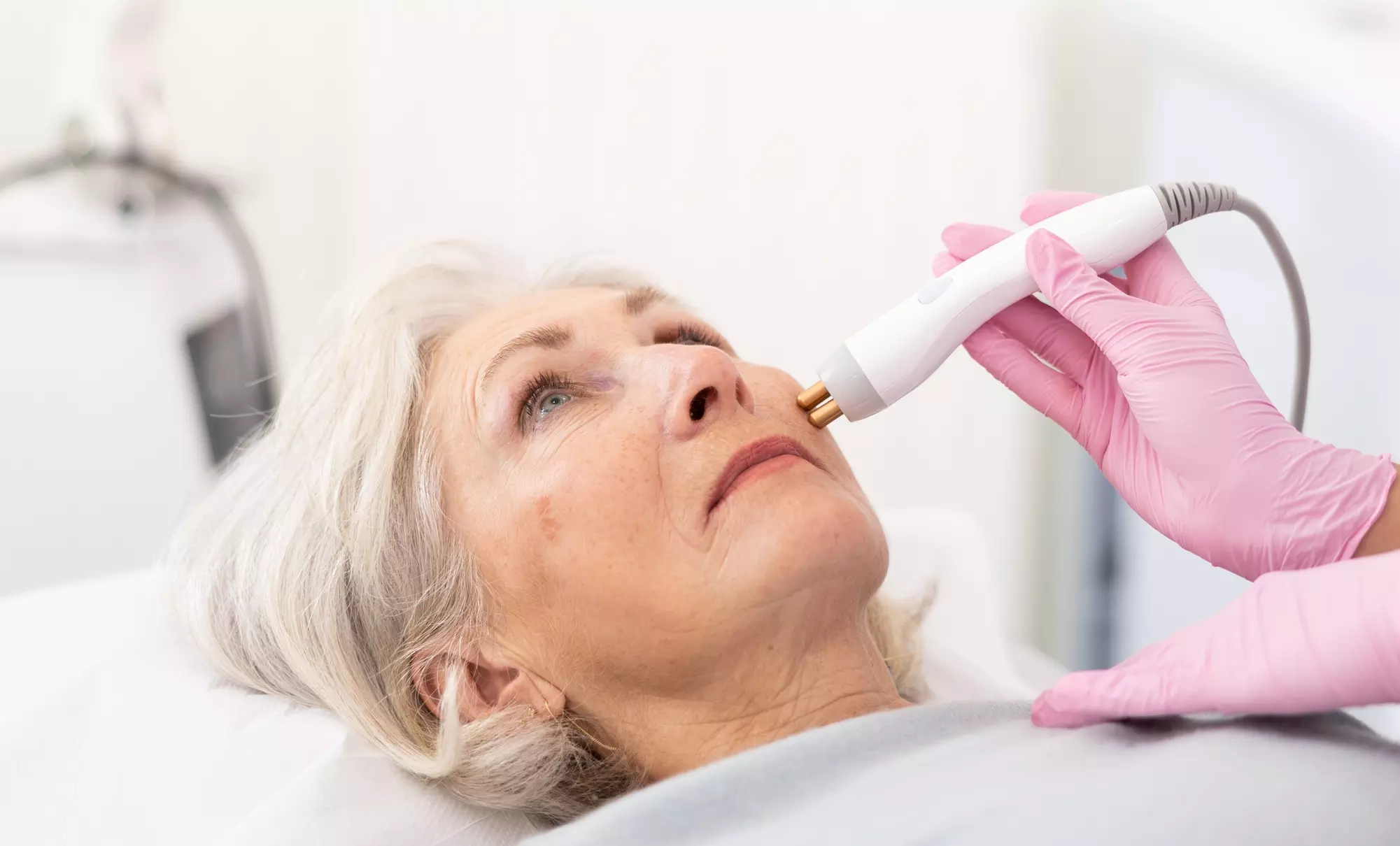 Up to 56% Off on Facelift - Non-Surgical at Refined Physique - Primary Image