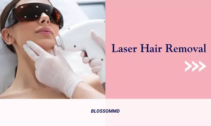 Say Goodbye To Unwanted Hair: Laser Hair Removal