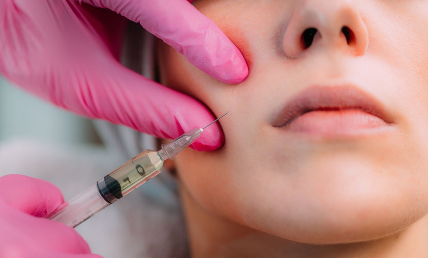 Image 1: Up to 52% Off on Injection - Dermal Filler at UK Aesthetics Lounge