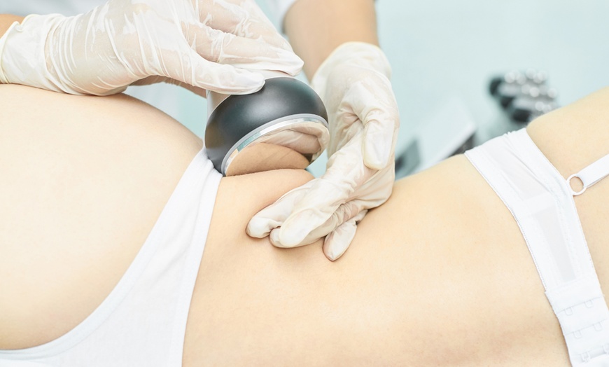 Image 8: Non-Invasive Cryo-Lipo Treatment for Stubborn Areas