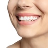 Image 1: One-Hour Phillips Zoom In-Office Laser Teeth Whitening with Consultation at Green Dental ( 40%
