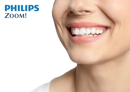 One-hour Phillips Zoom in-office laser teeth whitening treatment with consultation