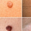 Image 5: Refresh Your Skin With a 30 Min Session or Get a Follow-Up