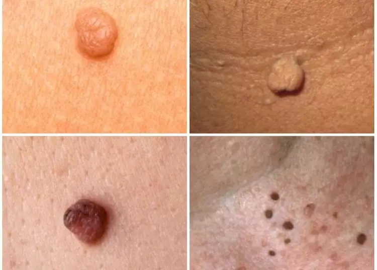 Refresh Your Skin With a 30 Min Session or Get a Follow-Up