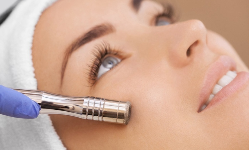 Enhance Your Glow with Angel M. Brant's Microdermabrasion Options, Available in Various Packages, Up to 40% Off