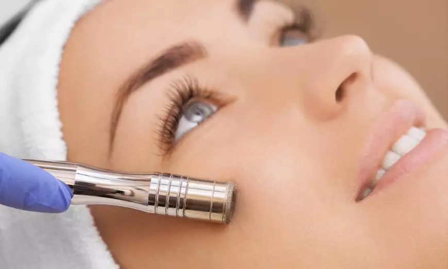 Enhance Your Glow with Angel M. Brant's Microdermabrasion Options, Available in Various Packages, Up to 40% Off - Primary Image
