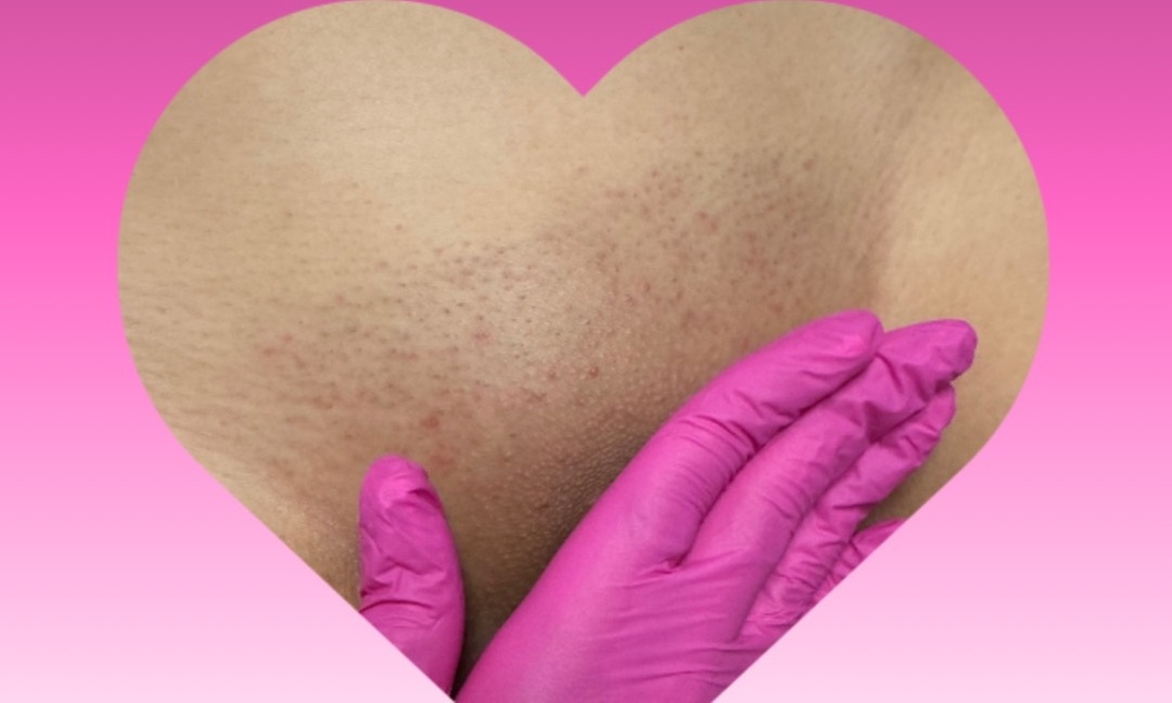 Up to 52% Off on Sugaring at Pinked SF