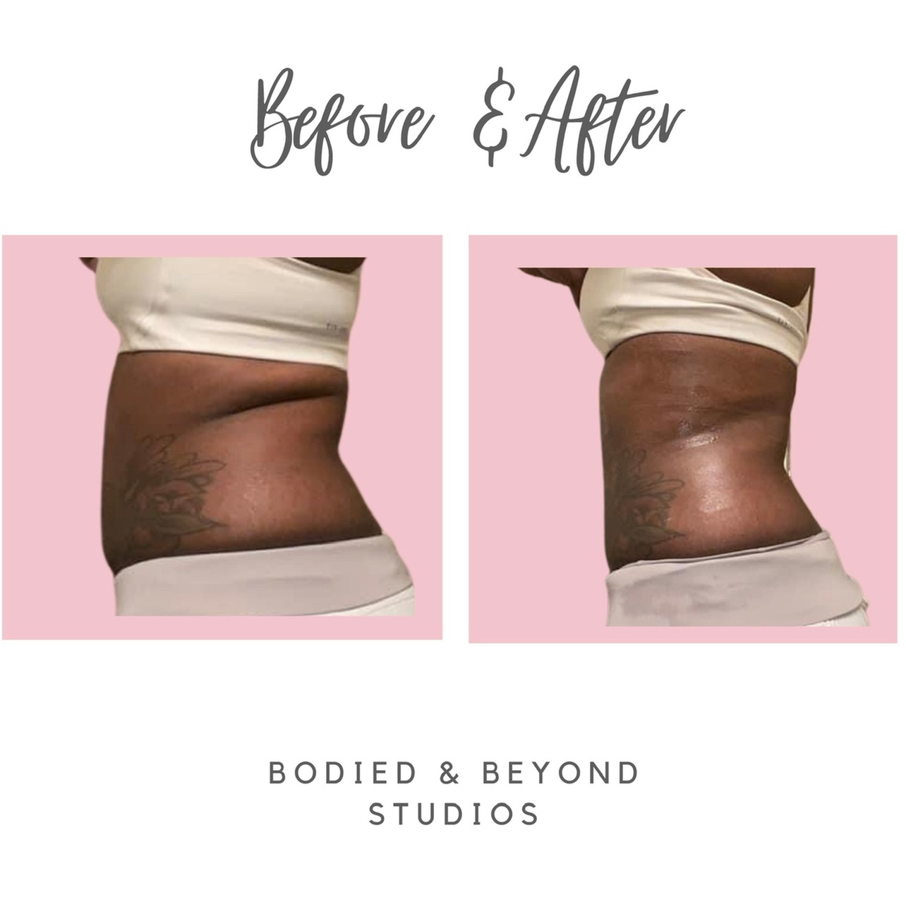 Up to 15% Off on Ultrasonic Fat Reduction at Bodied & Beyond Studios