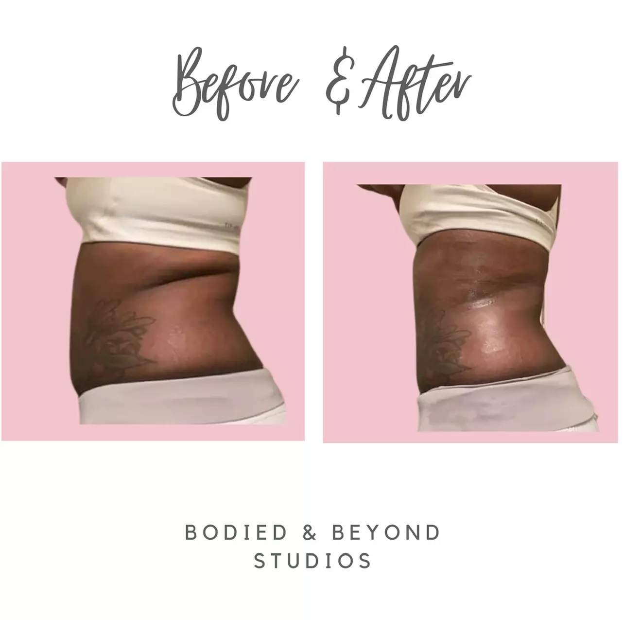 Up to 24% Off on Ultrasonic Fat Reduction at Bodied & Beyond Studios