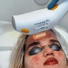Image 4: Revitalize Your Skin: 1 or 3 IPL Photofacials Sessions at Bye 2 Hair
