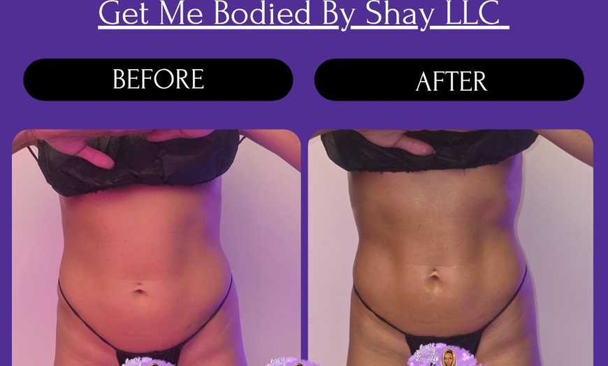 Image 3: 1 or 3 60-Min Lymphatic Drainage Massages with Optional Wood Therapy