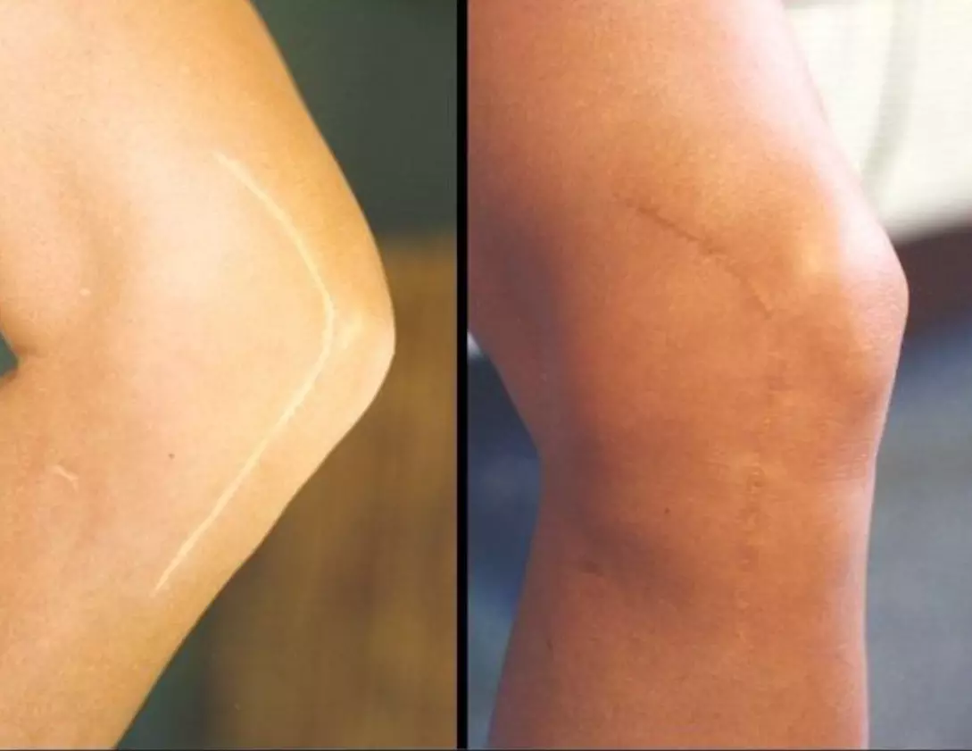 Up to 50% Off on Tattooing at On Point Permanent Makeup - Primary Image