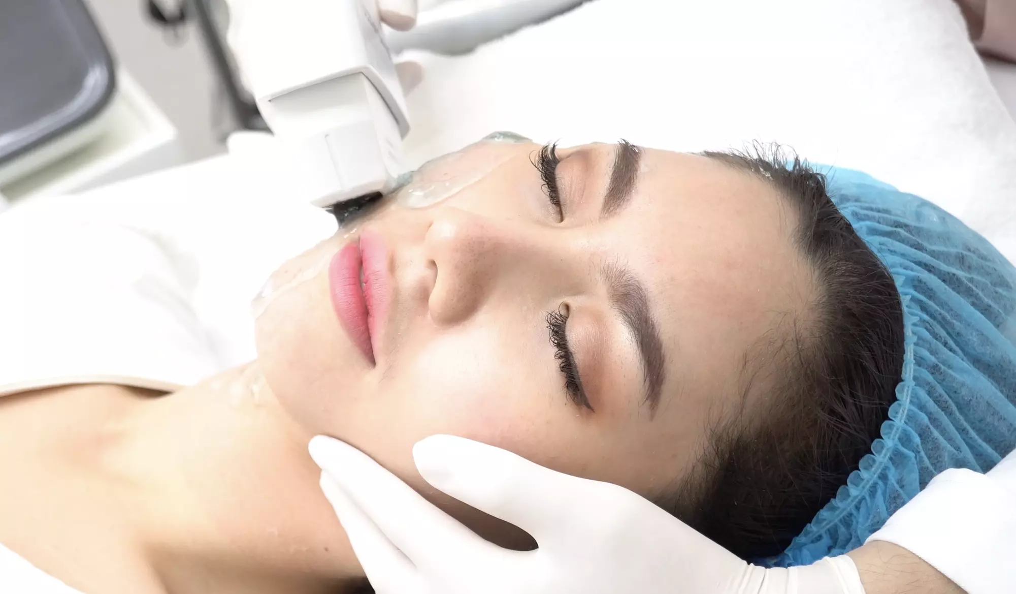Up to 60% Off on IPL-Intense Pulse Light Therapy at Blu Indigo Spa & Wellness - Primary Image