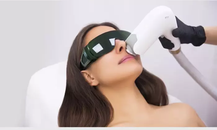 Up to 84% Off on IPL-Intense Pulse Light Therapy at Stuart Medspa - Primary Image