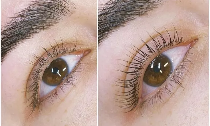 Enhance and Define Your Lashes with Better With Age Medspa's Eyelash Tinting and Lift Treatment Up to 35% Off  - Primary Image