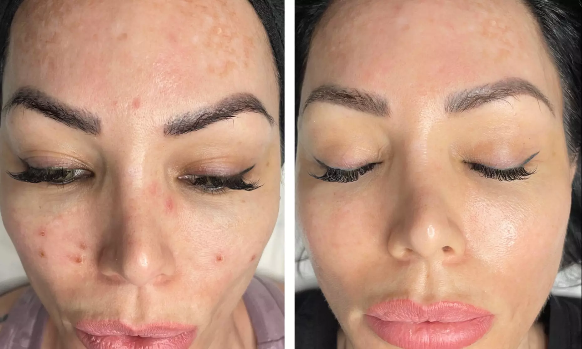 Enjoy a 60 Minute Oxygen Facial at Glow House Esthetics with up to 50% off - Second Medium