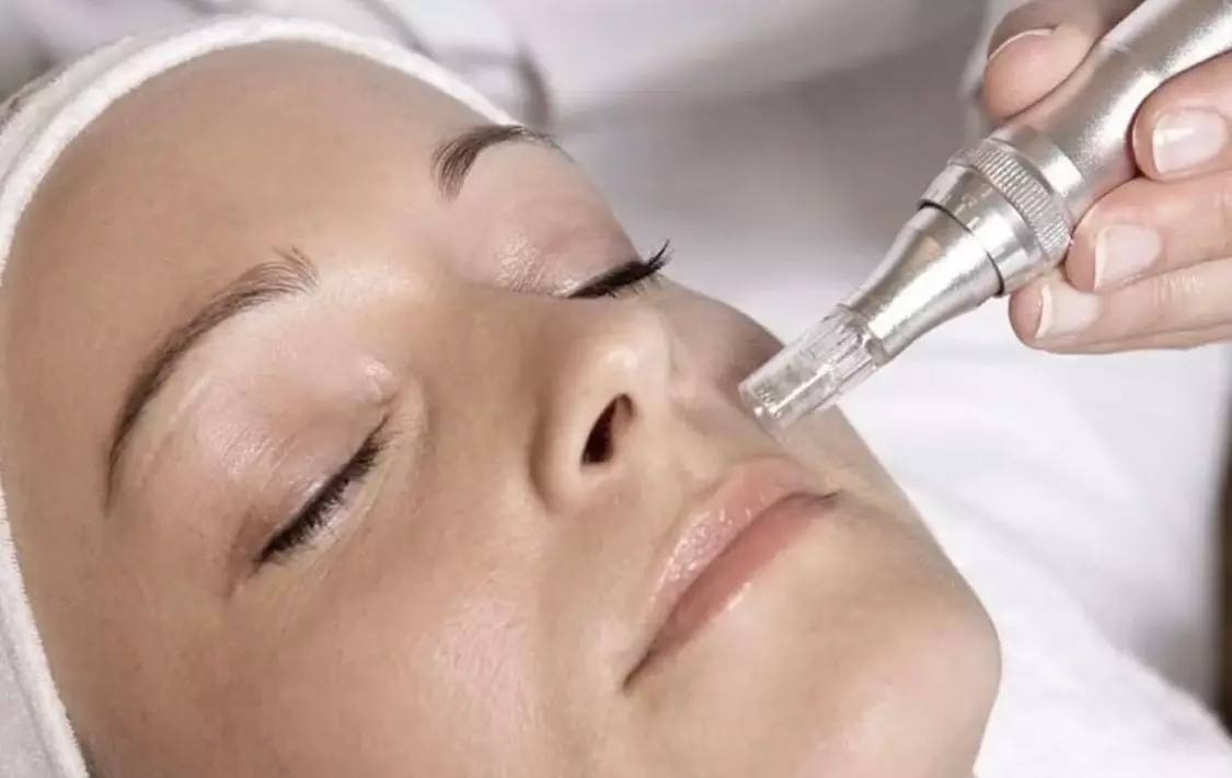 Experience The Blessings Medical Clinic's rejuvenating Microneedling