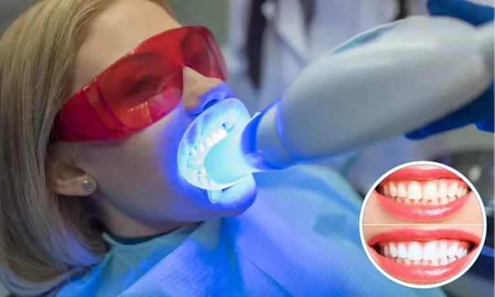 Up to 57% Off on Teeth Whitening at Simply Bright Smiles LLC - Primary Image
