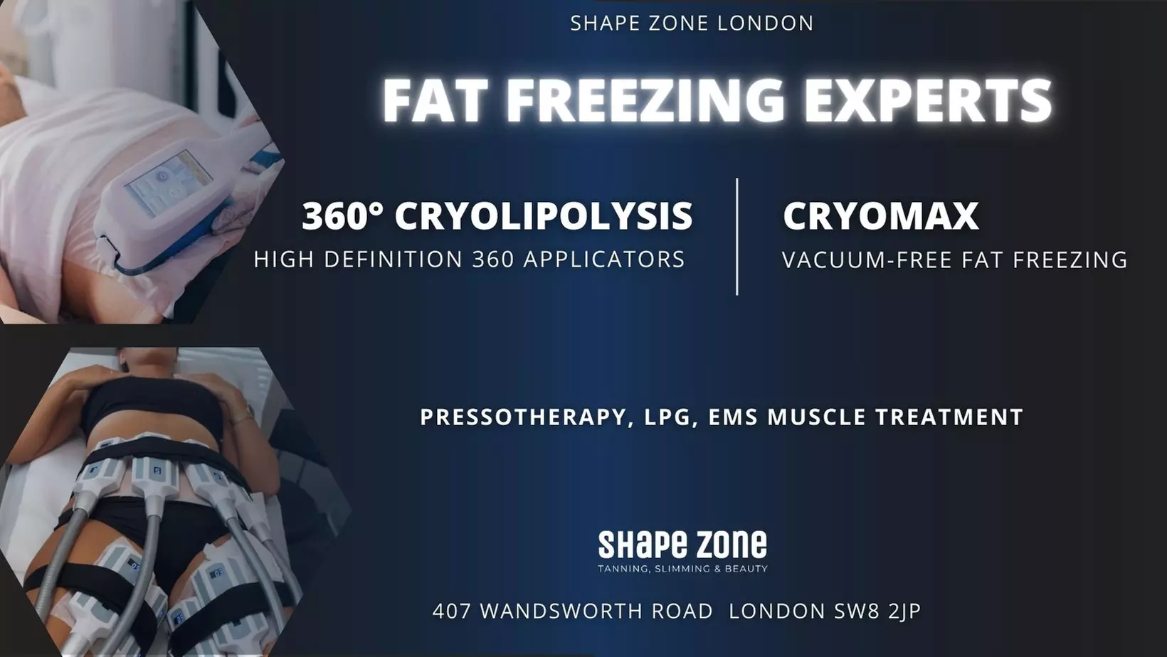 Expert Body Sculpting & Fat Freezing Packages at Shape Zone London - Primary Image