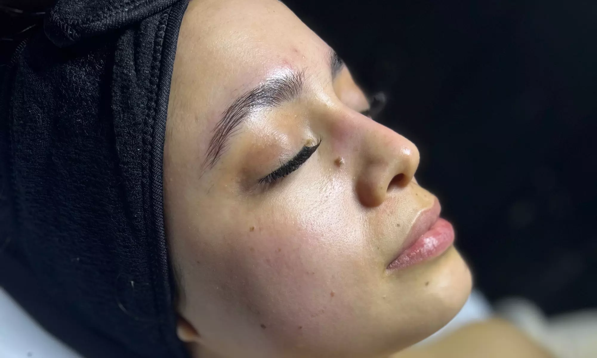 Up to 30% Off on Facial - Chosen by Customer at Sknn Haus - Second Medium