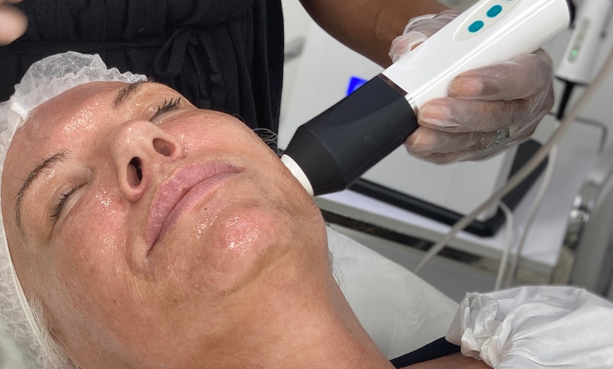 Image 7: OxyGeneo Facial 4 in 1 Single Session or 4 in 1 Course of 3 Session