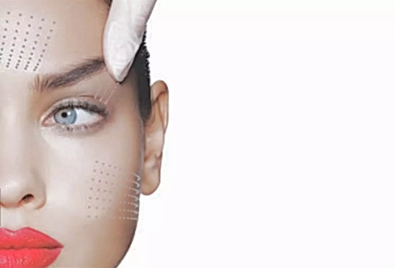 Up to 46% Off on Plasma Fibroblast Treatment at Isabelle Franco Ink Esthetics - Primary Image