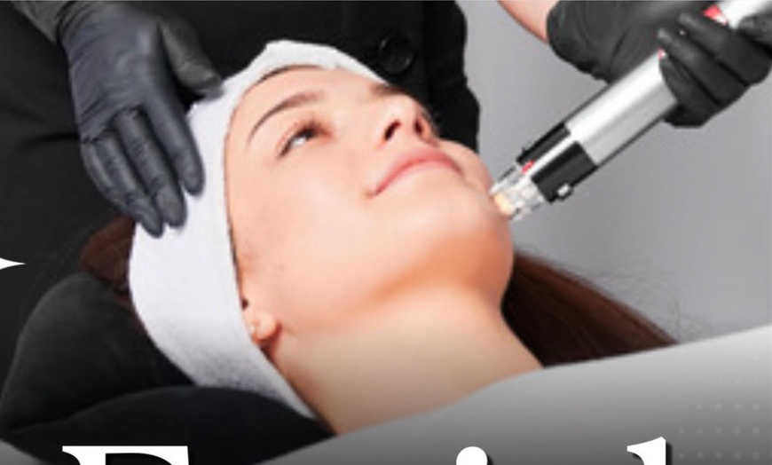 Image 2: Up to 35% Off on Facial at Beauty By Mila
