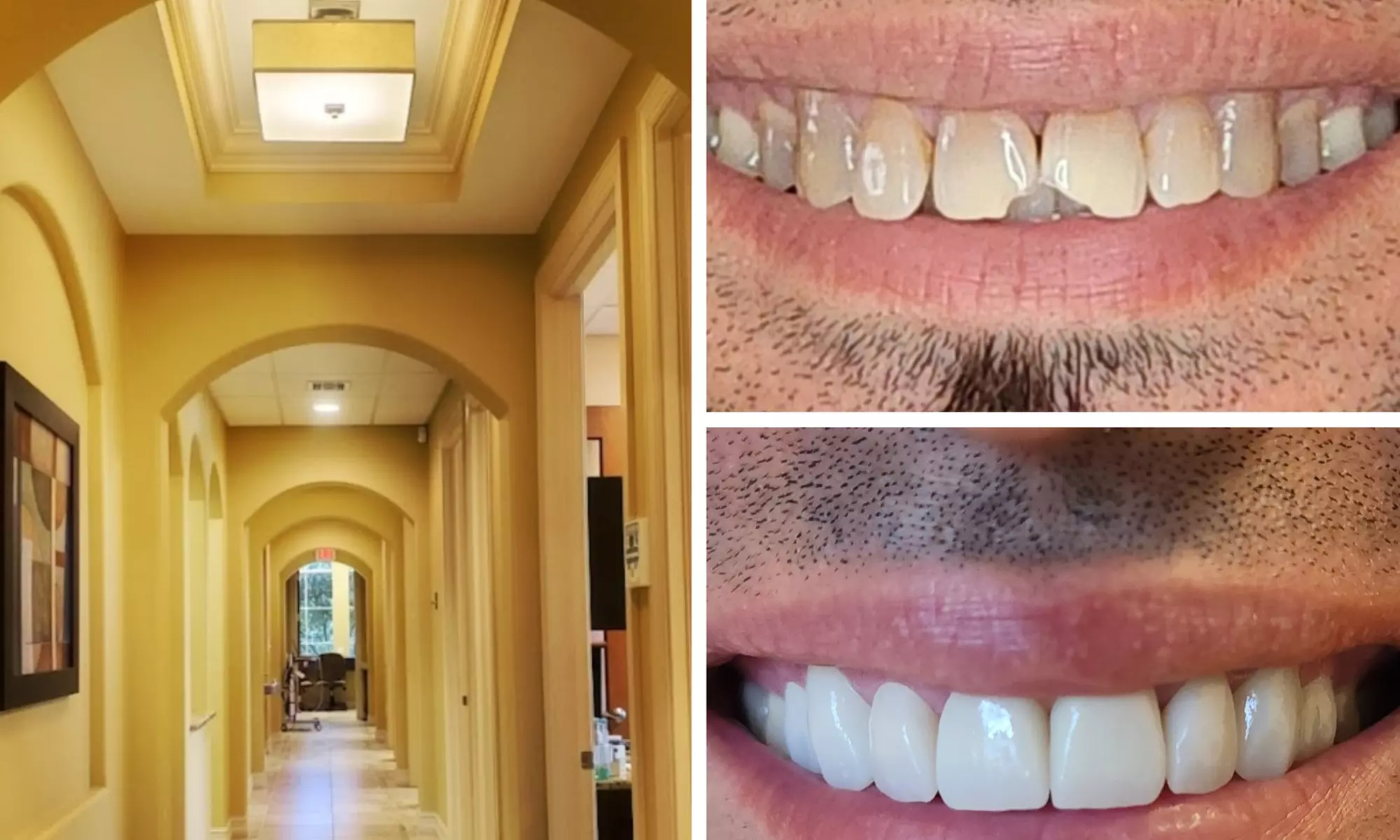 Up to 74% Off on Denture Services at Jupiter Dental Studio - Primary Image