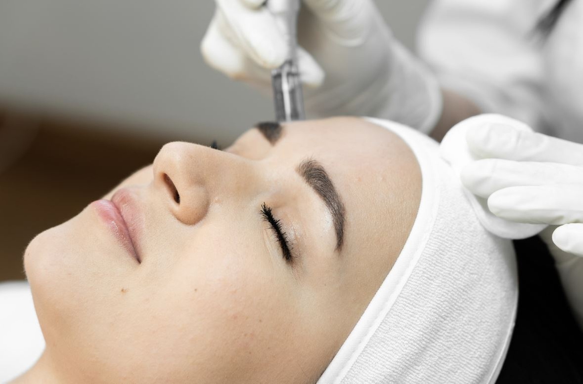 Cutera Pearl Laser Skin-Resurfacing Session for Face and Optional Neck