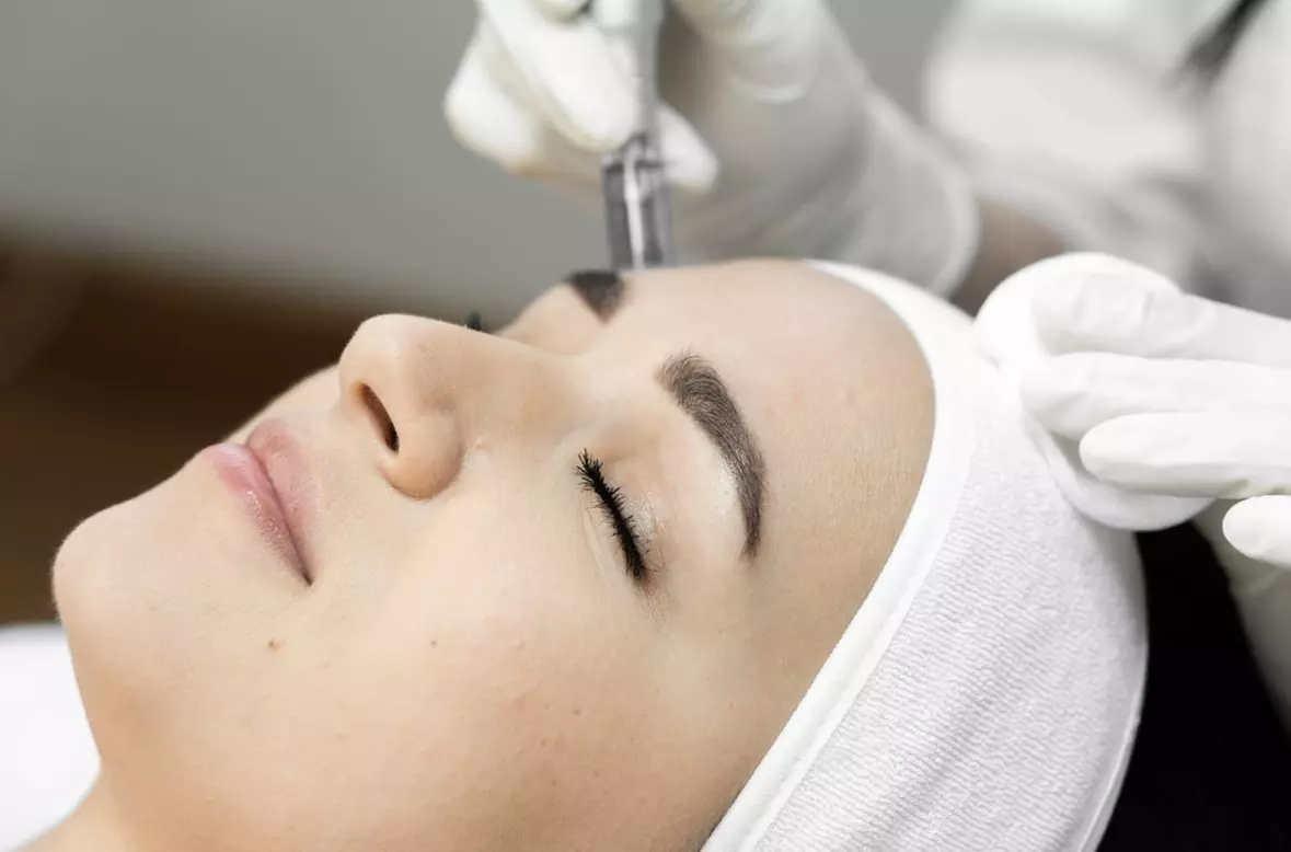 Up to 50% Off on Laser Skin Resurfacing - Branded at Elevated Image & Aesthetic Clinic - Primary Image
