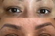 Up to 50% Off on Facelift - Non-Surgical at About Face Esthetics - Second Medium
