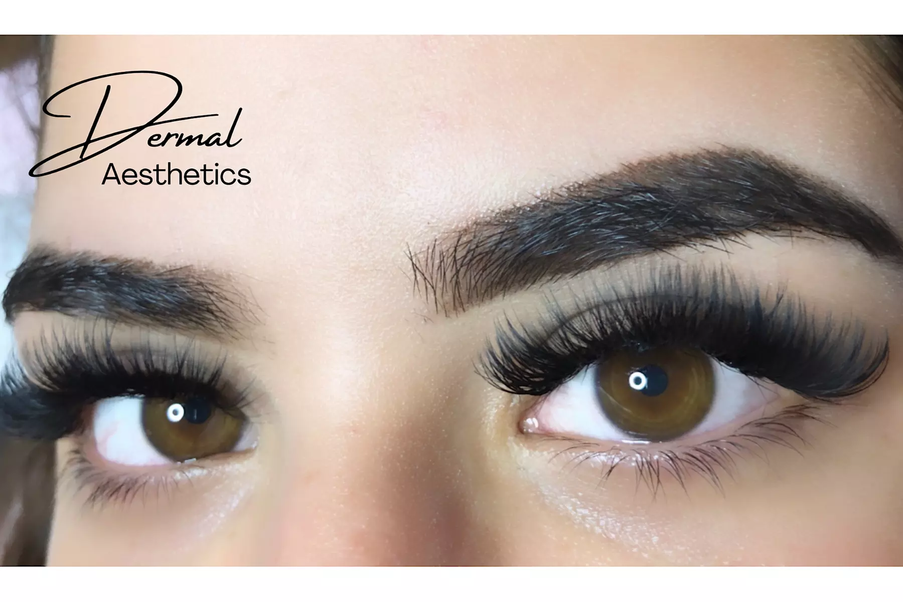 Bis zu 60% Rabatt auf den Wimpernverlängerungen bei Dermal Aesthetics - Primary Image