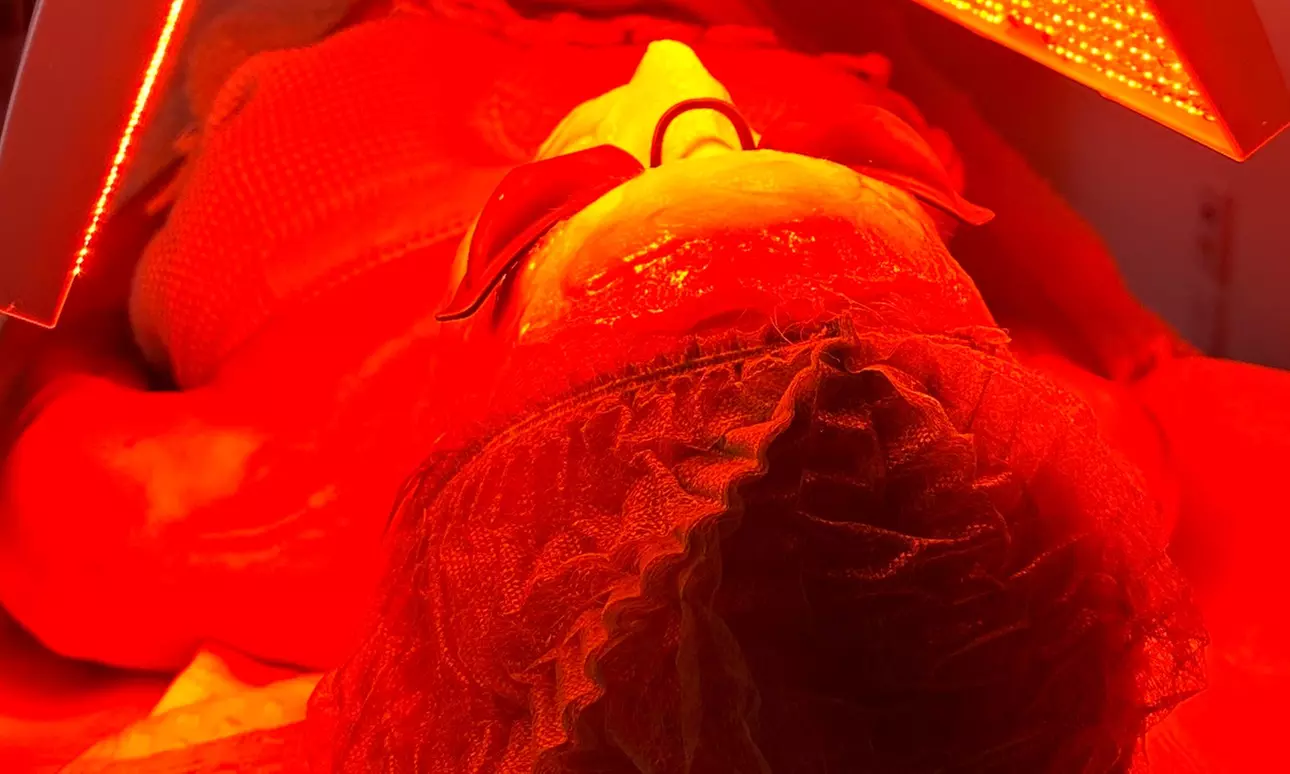 Transform your skin at Takohs Beauty Studio with a carbon peel, cleansing facial, or microneedling facial treatment up to 44% - Second Medium