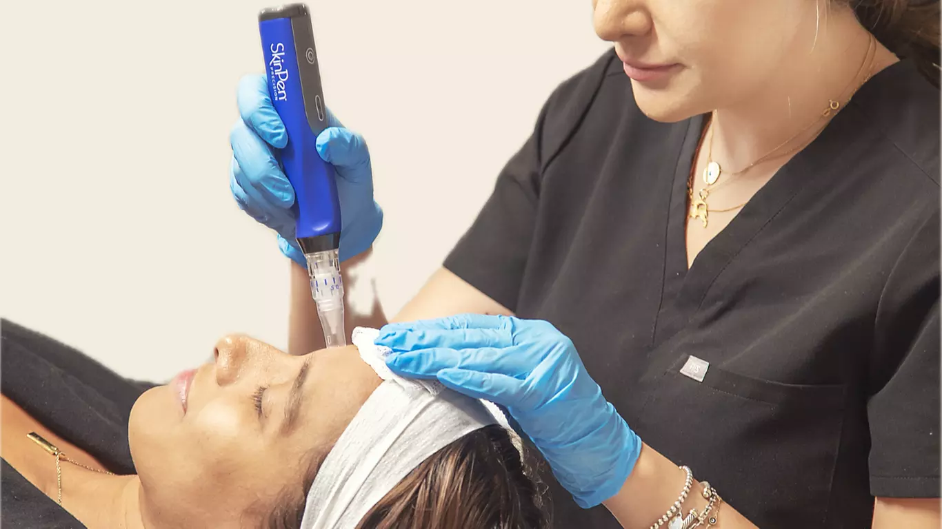Up to 37% Off on Micro-Needling at Dripology  - Primary Image