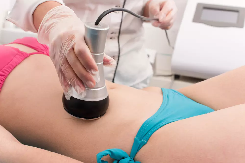 Up to 50% Off on Cavitation at Dr. Marla's ChiroWellness Spa