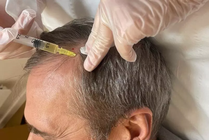 Up to 29% Off on Ethnic Hair Service - Natural at H Ross Aesthetics