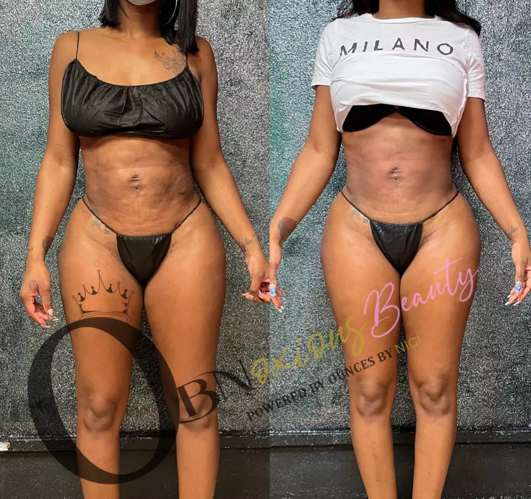 One or Three 60-Minute Body Contour Treatments with Cavitation & More