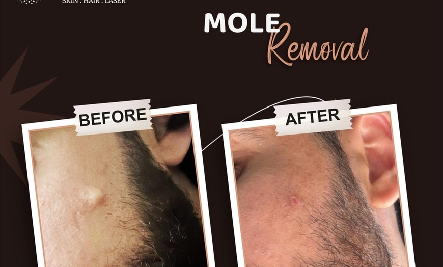 Image 5: Radiant Skin Transformation With Hydrafacial