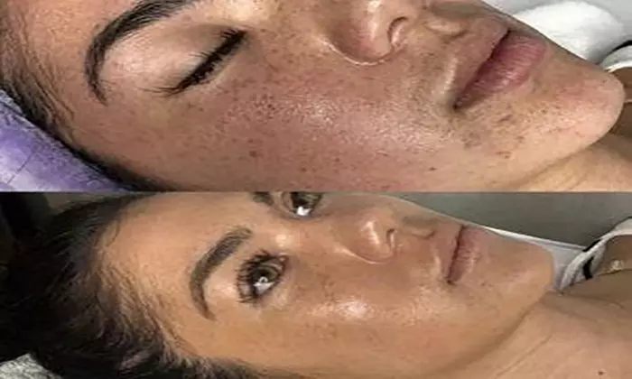 Up to 43% Off on Facial at Beauty on The Beat LLC - Second Medium