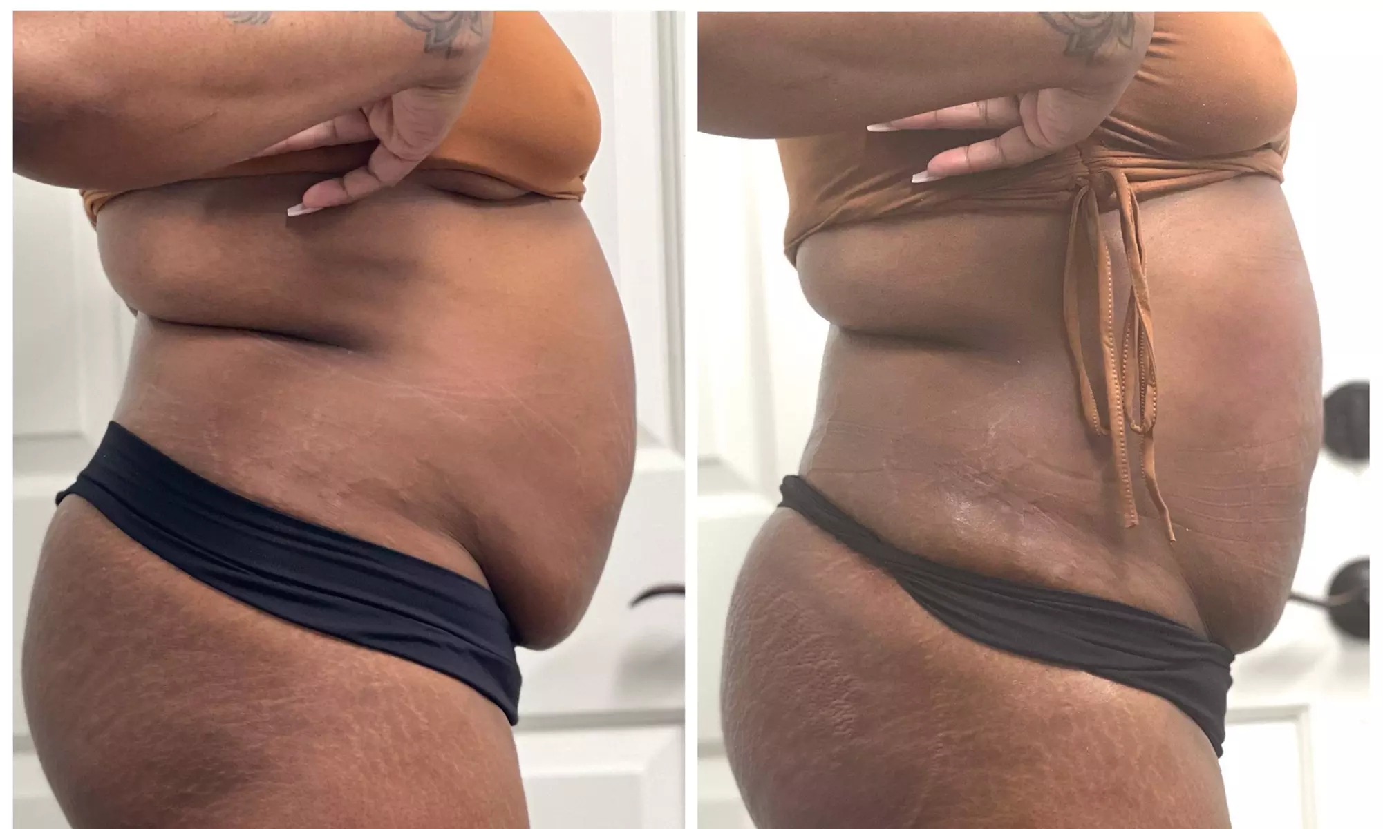 Up to 10% Off on Ultrasonic Fat Reduction at CloZet Therapy & Beauty Body Sculpting and Contour - Primary Image