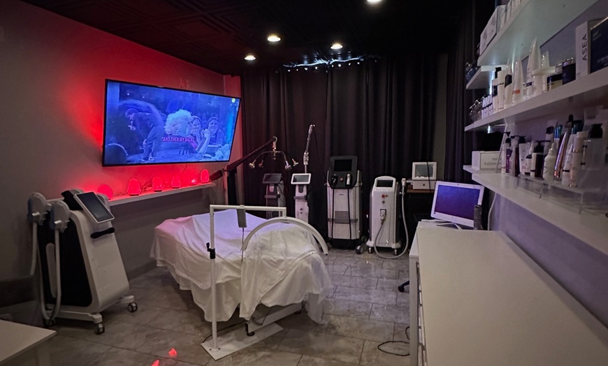 Image 6: Reveal Smooth, Youthful Skin: One, Two or Three Laser Spider-Vein Removal Sessions at Loma Laser - Up to 67% Off