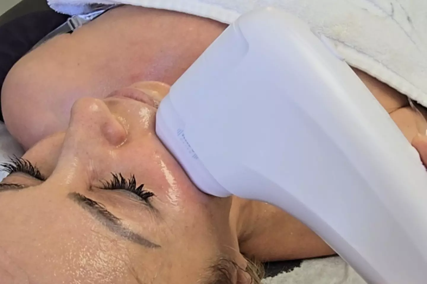 Up to 58% Off on Micro-Needling at Dr. Kwang Lee Wellness Center INC