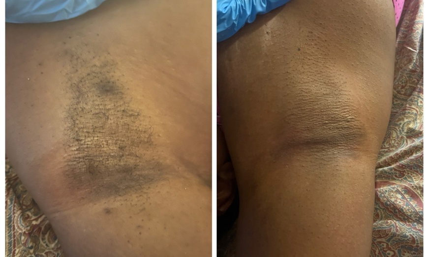 Image 1: Feel Confident with One Women or Men Brazilian Wax Treatment  