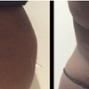 Image 2: Fat / Cellulite Reduction - Non-Branded at Dpz parlour